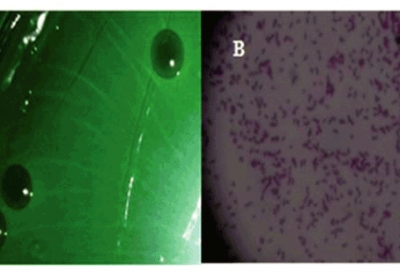 Giải pháp kiểm soát bệnh do vi khuẩn Vibrio